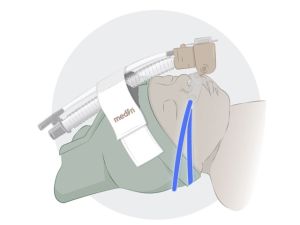 Тесемки для аппарата СРАР терапии CNO одноразовые, длина 13 см